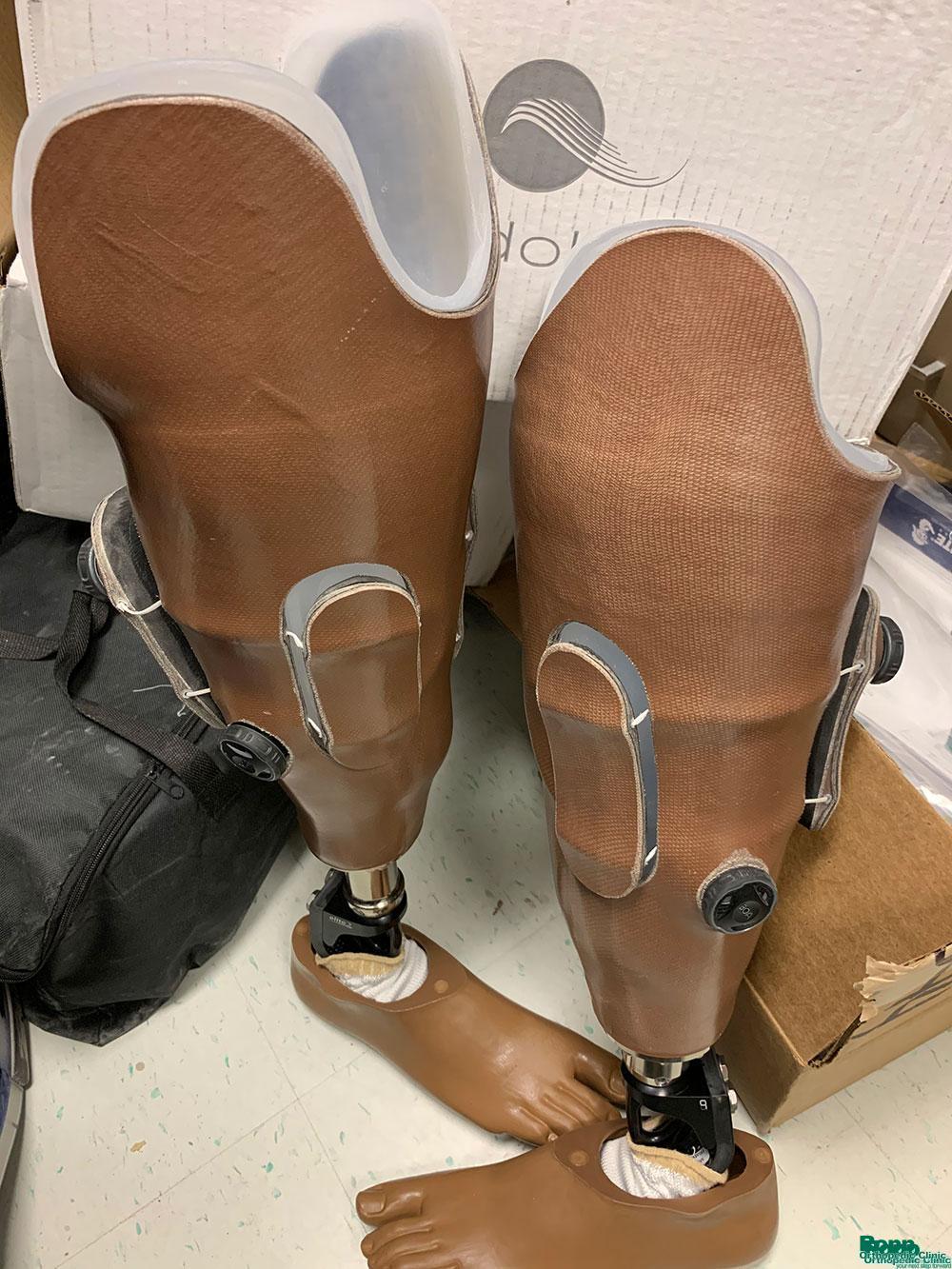 Double amputee prostheses ready for the next fitting.